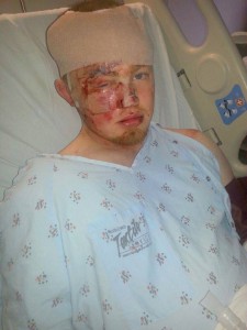 Robert Lanenga, injured after a hit and run incident last weekend.